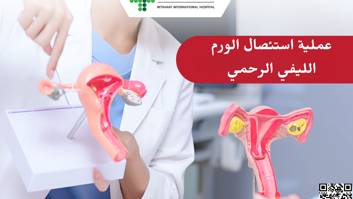 إنجاز طبي في مقاطعة موسكو: استئصال ورم ليفي رحمي عملاق يتجاوز وزنه 3 كيلوغرامات