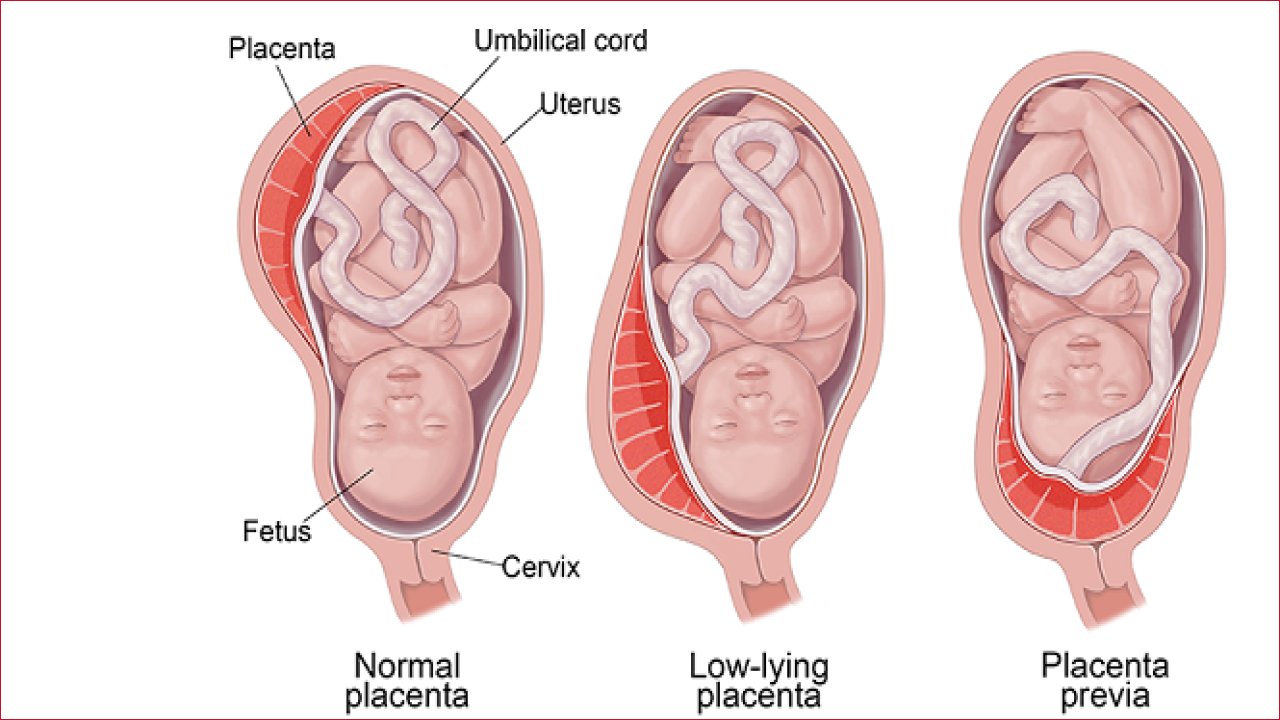 اكتشاف بيولوجي يفتح الباب لإنقاذ الأجنة من الإملاص