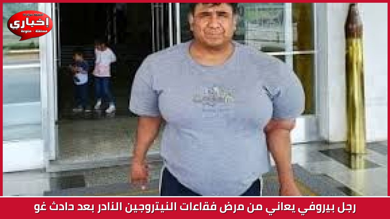 رجل بيروفي يعاني من مرض فقاعات النيتروجين النادر بعد حادث غو