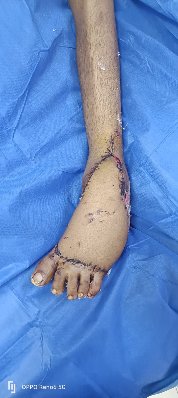 إنجاز  وملحمة جديدة  لقسم جراحه التجميل بمستشفى حورس